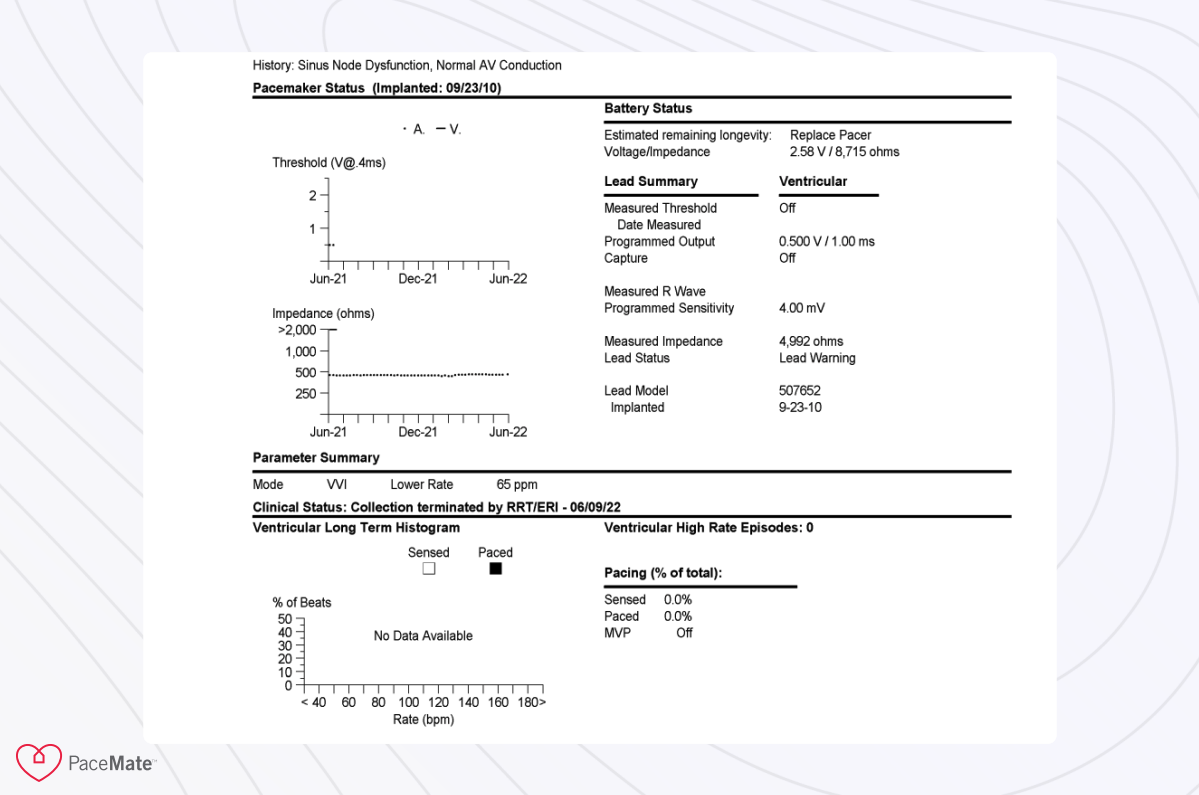 Case Report Impact of Replacement Time Pacing Behavior in